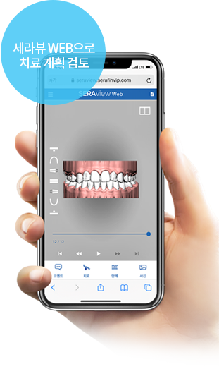 세라뷰 WEB으로 치료 계획 검토
