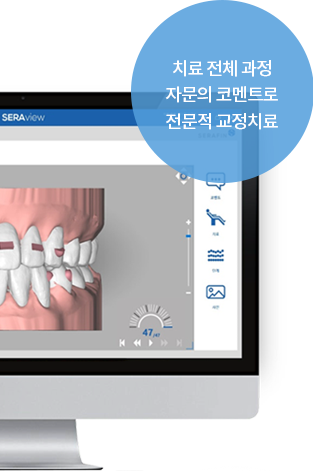 치료 전체 과정 자문의 코멘트로 전문적 교정치료