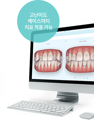 고난이도 케이스까지 치료 적용 가능