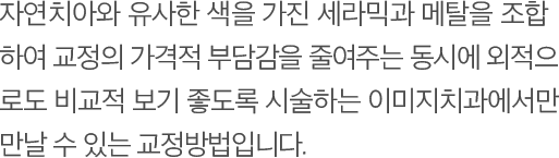 자연치아와 유사한 색을 가진 세라믹과 메탈을 조합 하여 교정의 가격적 부담감을 줄여주는 동시에 외적으로도 비교적 보기 좋도록 시술하는 이미지치과에서만 만날 수 있는 교정방법입니다.