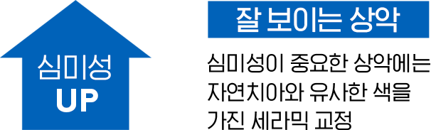 잘 보이는 상악