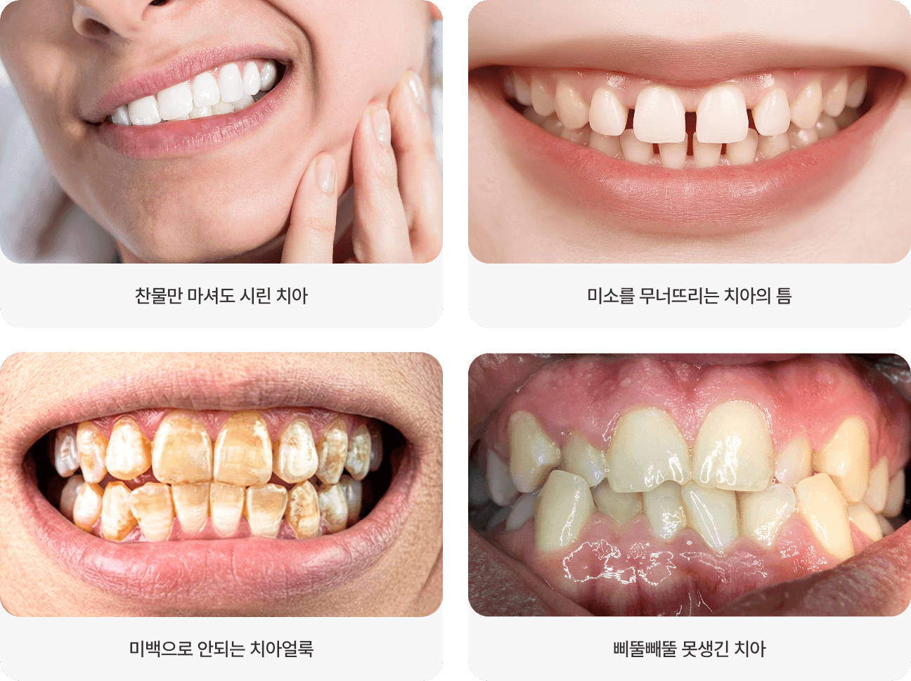 찬물만 마셔도 시린 치아, 미소를 무너뜨리는 치아의 틈, 미백으로 안되는 치아얼룩, 삐뚤빼뚤 못생긴 치아