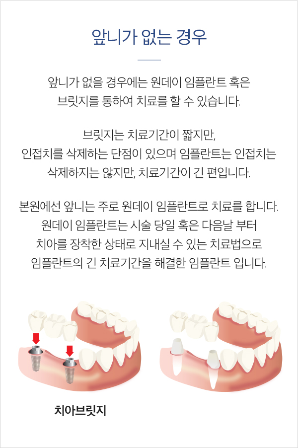 앞니가 없는 경우