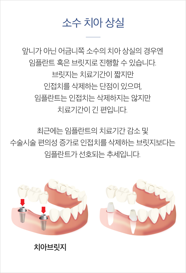 소수 치아 상실