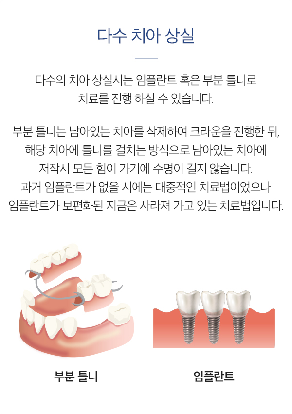 다수 치아 상실